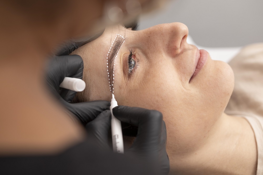 Eyebrow Lift